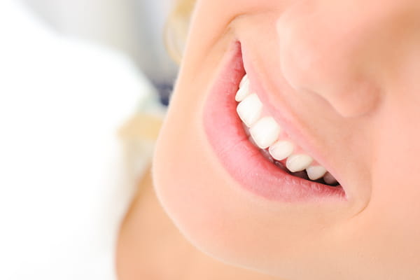 Como atrair clientes para consultório odontológico: sorriso super branco de uma mulher.