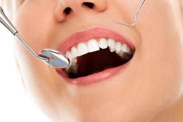 Técnicas essenciais de mercadologia para clínica odontológica: mulher fazendo tratamento dentário.